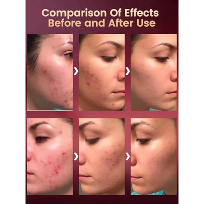 STRBOXONG قناع علاج الوجه بالضوء LED - قناع LED قابل للطي بألوان 7 وألوان دورية لعلاج الضوء للعناية بالبشرة - علامات تجارية أخرى تبيع هذا المنتج بدون موافقتنا، يرجى عدم شرائه - Image 4